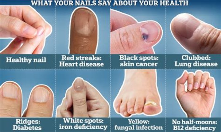 What happens if nails become black